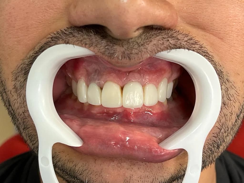 Imagem de depois de um tratamento dental